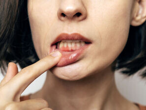 Bild zu Mundgesundheit - Der Oral-Systemische Link