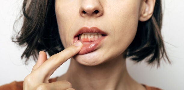 Bild zu Mundgesundheit - Der Oral-Systemische Link – ein Überblick über die starke Korrelation zwischen Diabetes mellitus, Parodontitis und COVID-19-Outcome