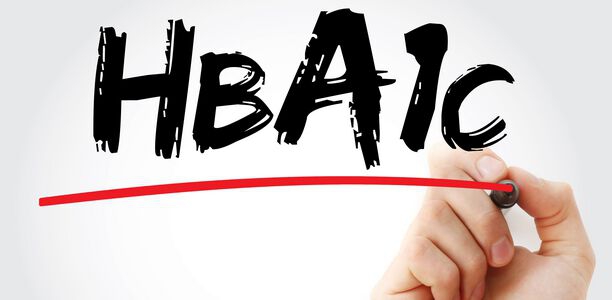 Bild zu Editorial - Der heilige Gral