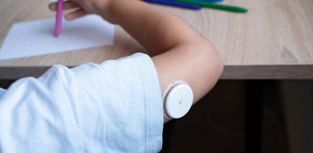 Bild zu Originalie - Evaluierung des SPECTRUM-Schulungs- und Behandlungsprogramms zum rtCGM in der pädiatrischen Diabetologie