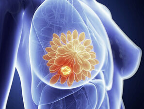 Bild zu Schwerpunkt "Ernährung" - Diabetes-Risiko nach Brustkrebs