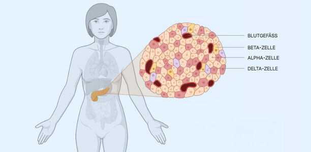 Bild zu Typ‑2‑Diabetes - Erklärbare Künstliche Intelligenz zeigt strukturelle Veränderungen im Pankreasgewebe