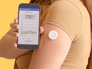 Bild zu Neue Studie - Grenzen der Vergleichbarkeit von CGM-Messdaten