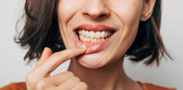 Bild zu Neue S2k-Leitlinie - Diabetes und Parodontitis