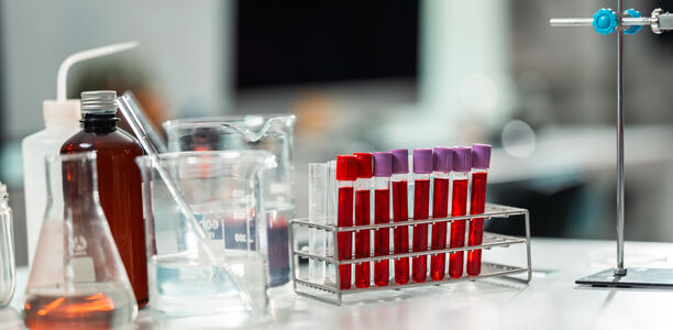 Bild zu KLD - Bedeutung der Präanalytik für eine zuverlässige Glukose- und Kaliummessung: Dichtung und Wahrheit