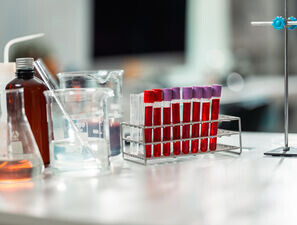 Bild zu KLD - Glukose- und Kaliummessung: Dichtung und Wahrheit