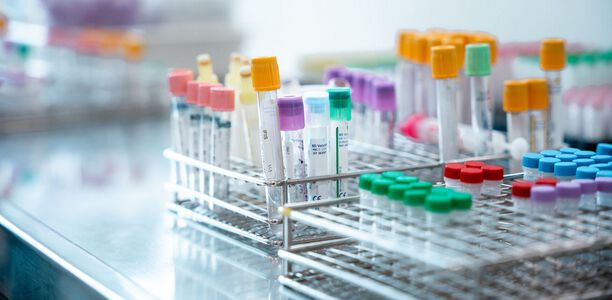 Bild zu Neben Insulin: - Welche Rolle spielt die hepatische Glukagonresistenz bei Typ-2-Diabetes?