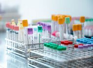 Bild zu Neben Insulin: - Rolle der hepatischen Glukagonresistenz bei Typ-2-Diabetes