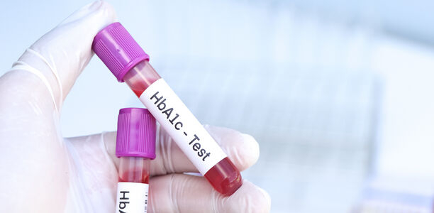 Bild zu Kooperation: KLD - Angabe von HbA1c-Messergebnissen: mit oder ohne eine weitere Dezimalstelle?